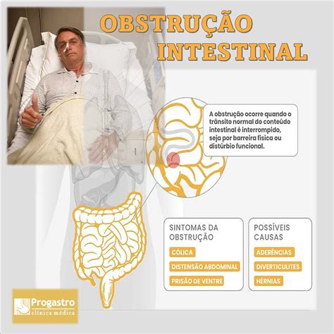 O Que Causa Obstrução Intestinal