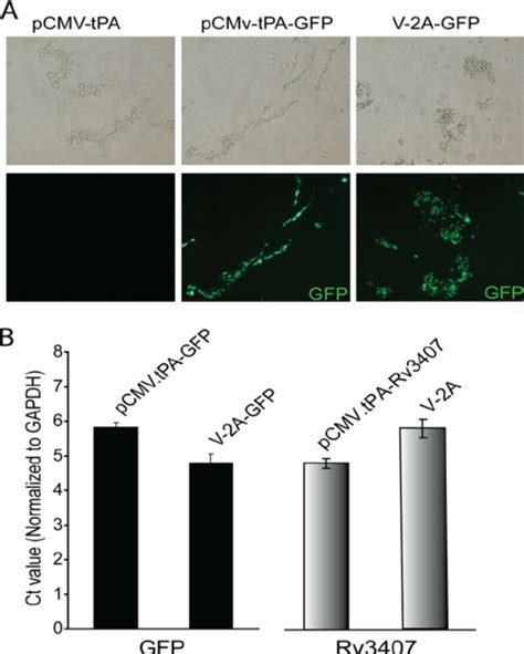 Quantification of expression levels. (A) GFP expression detected by ...