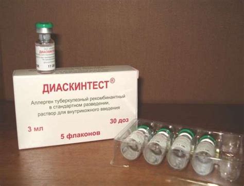 "Diaskintest" за деца (20 снимки): норма и противопоказания, от каква ...