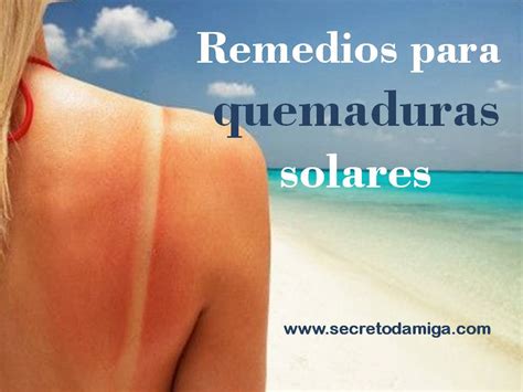 Remedios Para Las Quemaduras Solares Secretodamiga