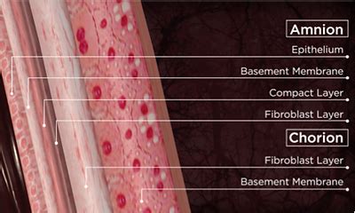 Amniotic Membrane Allograft | Cincinnati & Northern Kentucky