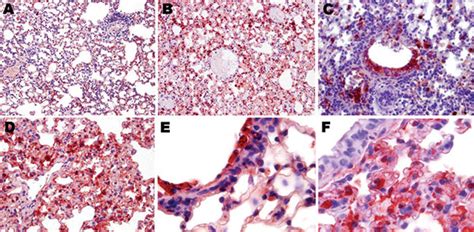 Figure 6 Influenza A Strain Dependent Pathogenesis In Fatal H1N1 And