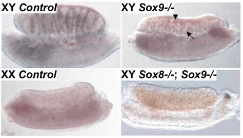 Sex Reversal In Xy Sox9 Versus Xy Sox8 Sox9 Mutant Fetuses At E135