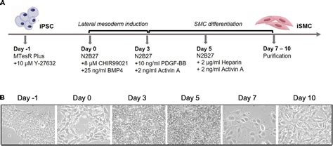 Frontiers Induced Pluripotent Stem Cell Derived Smooth Muscle Cells