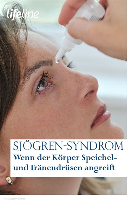 Das Sjögren Syndrom ist eine chronisch fortschreitende Erkrankung bei