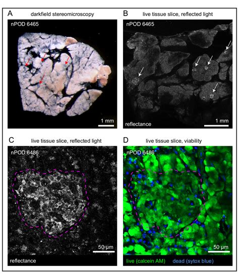 Observing Islet Function and Islet-Immune Cell Interactions in Live ...