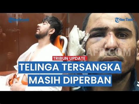 Tampang Tersangka Teror Balaikota Crocus Ada Masih Diperban Telinganya