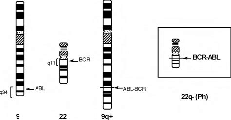 The Philadelphia Chromosome The Q Q Reciprocal