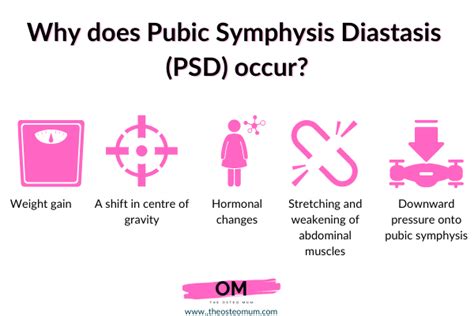 6 Management Tips For Pubic Symphysis Diastasis Separation The