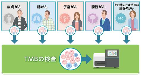 Tmbの検査（がん遺伝子パネル検査）とは Msd Oncology がんを生きる