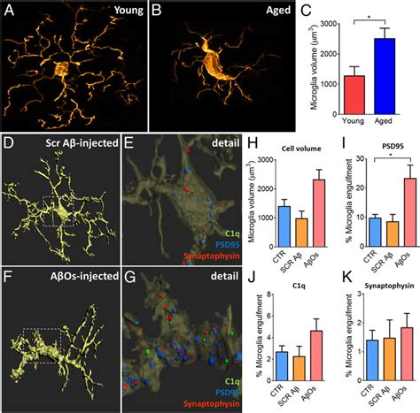 Aging and AβO infusion induce morphological changes in microglia A C