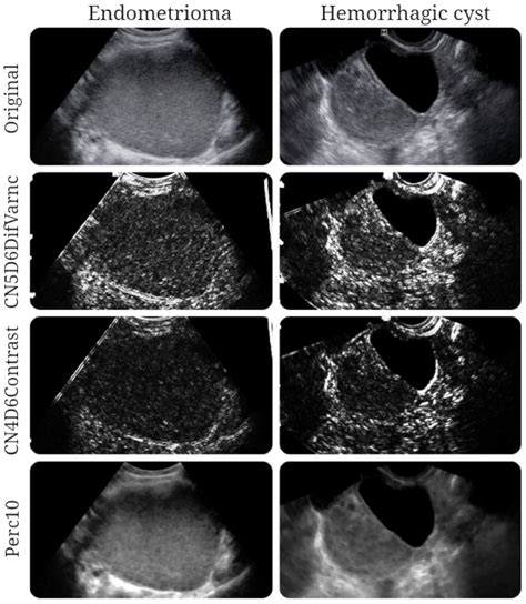 Jpm Free Full Text Ultrasonography In The Differentiation Of