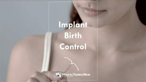 Implant Birth Control In The Philippines: Price, Removal, Pros and Cons ...