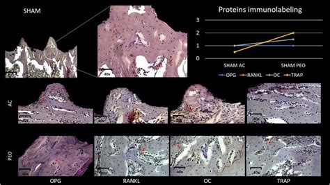 Representative Photomicrograph With Increase In Magnification Of