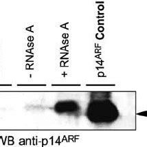 p14 ARF is released from 293 cells following RNAse A treatment 2 Â 10