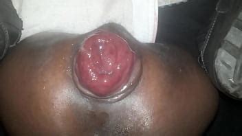 Culo Hinchado Con Ganas De Coger Xvideos
