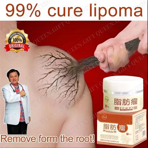 30g Lipoma Removal Cream Treat Tumor Skin Swelling Ointment Natural