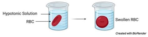 Hypotonic Solution : Definition and Examples