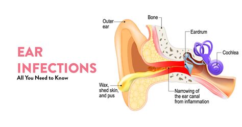 Various Ear Infections Explained By Leading Ent Doctor Ck Birla Hospital