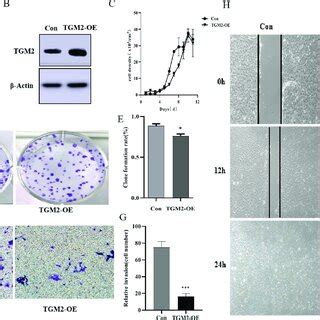 Effects Of Tgm Gene Knockout On Proliferation Migration And Invasion