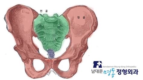 남대문명동정형외과 천장관절염좌 증상과 치료 네이버 블로그