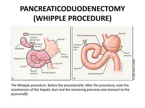 PPT - MANAGEMENT PowerPoint Presentation - ID:2192341 