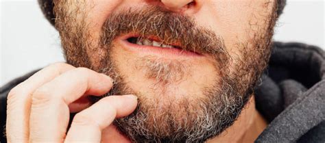 7 Common Beard Problems And How To Treat Them