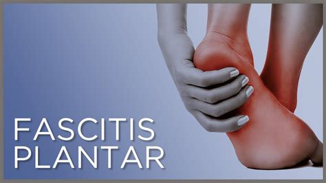 Dolor De Pie Y Fascitis Plantar Causas S Ntomas Y Tratamiento Youtube