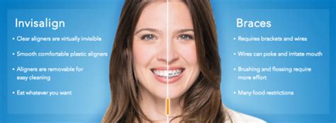 Everything You Need To Know About Invisalign Dentist