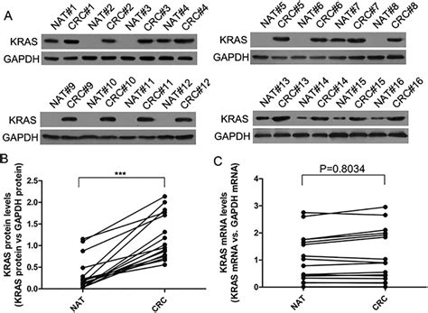 The Expression Of Kras In Human Crc Tissues A And B Western Blot