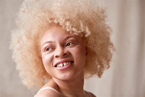 42 Albino African Long Hair Images, Stock Photos, 3D objects, & Vectors ...