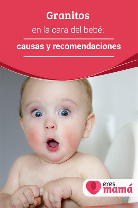 Granitos en la cara del bebé causas y recomendaciones Granitos en la