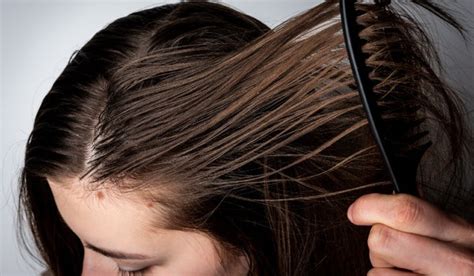 How to treat an oily scalp: Causes and Remedies - Abyssian