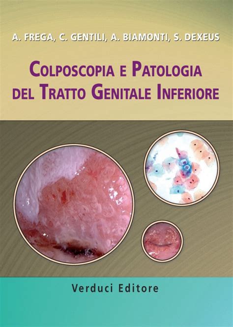 Colposcopia E Patologia Del Tratto Genitale Inferiore MEDICITALIA It