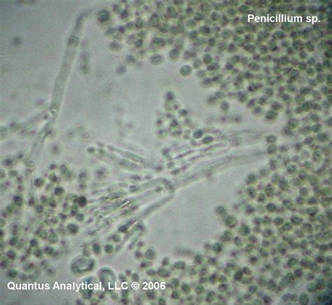 Airborne Mold Spores Increase Kids Risk For Multiple Allergies