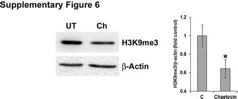 Chaetocin Induced ROS Mediated Apoptosis Involves ATM YAP1 Axis And JNK