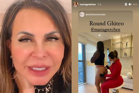 Gretchen Realiza Procedimento Para Deixar Bumbum Mais Empinado