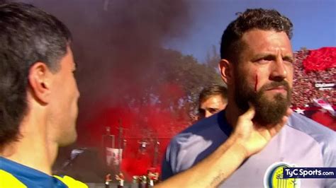 Broun fue agredido antes de Newell s vs Central y terminó con un corte