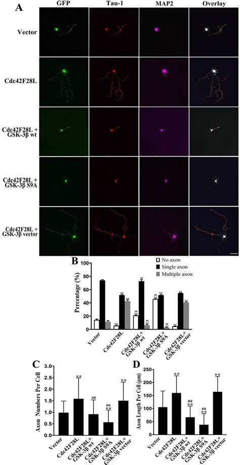 Effects of GSK 3β wt or GSK 3β S9A on axonogenesis of rat hippocampal