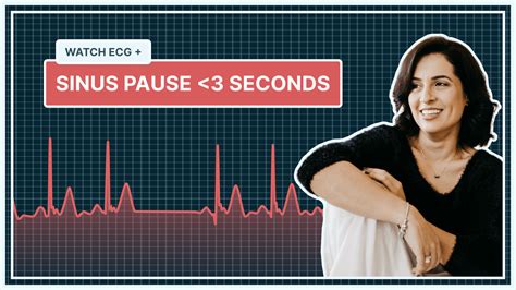 qaly  sinus pause