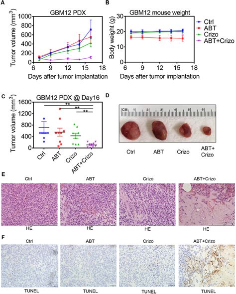 Dual Inhibition Of C MET And Bcl 2 Bcl XL Leads To Enhanced Tumor