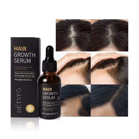 Wholesale Private Label Organic Herbal Fast Miracle Hair Treatment