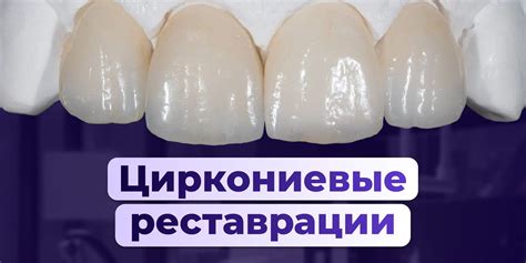 Обучение по протезированию несъемному, мостовидным протезам
