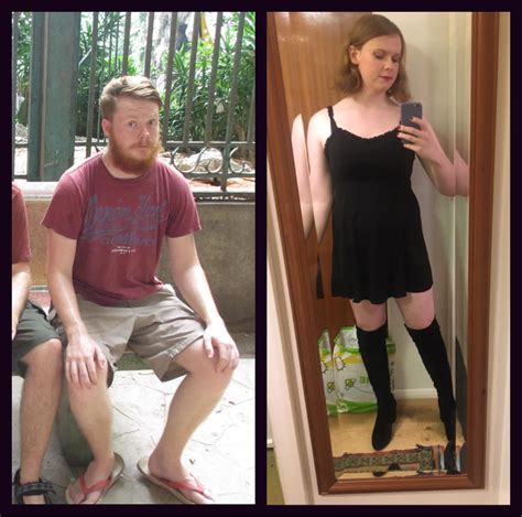 It’s Amazing What 2 Years And Some Little Pills Can Do D 14 Months Hrt R Transtimelines