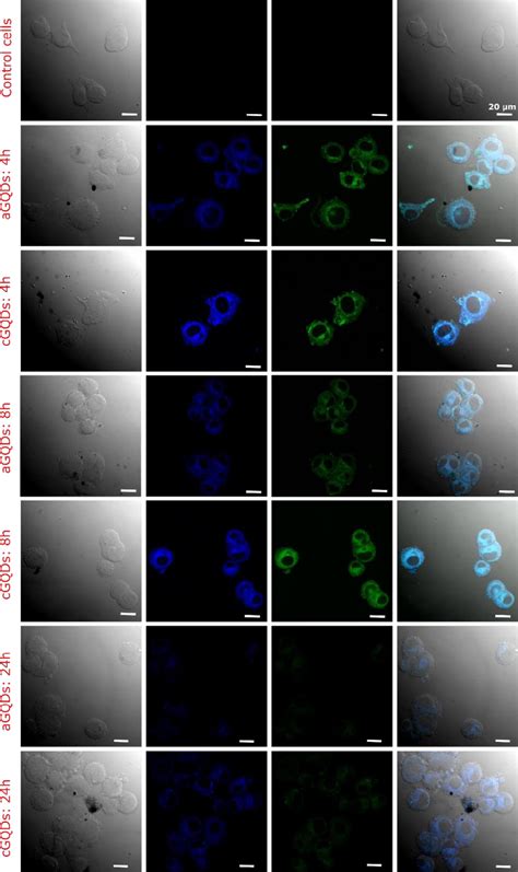 Confocal Fluorescence Images Of Sk Mel Cells Showcasing The Uptake