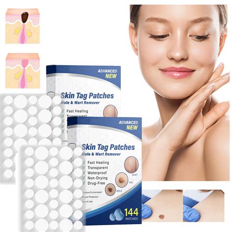 288 DB TAPASZ FIBROMA ELTÁVOLÍTÓ APPLIKÁTORRAL – HATÉKONY ELTÁVOLÍTÁS
