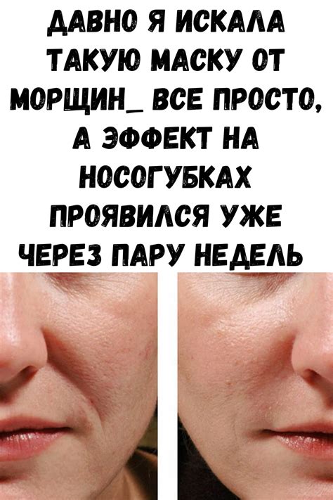 Маска от морщин. Все просто, а эффект на носогубках проявился уже через ...