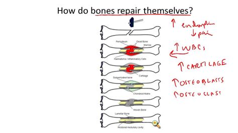 Skeletal System Structure and Function - Example 2 ( Video ) | Biology ...