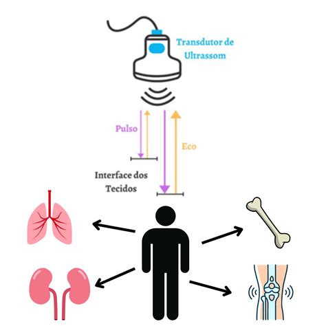 Exame De Ultrassom O Que é Medicina Ortopédica