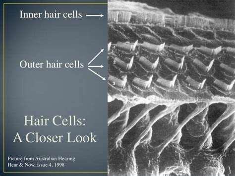 Hair cell function and purpose